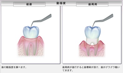 動揺度